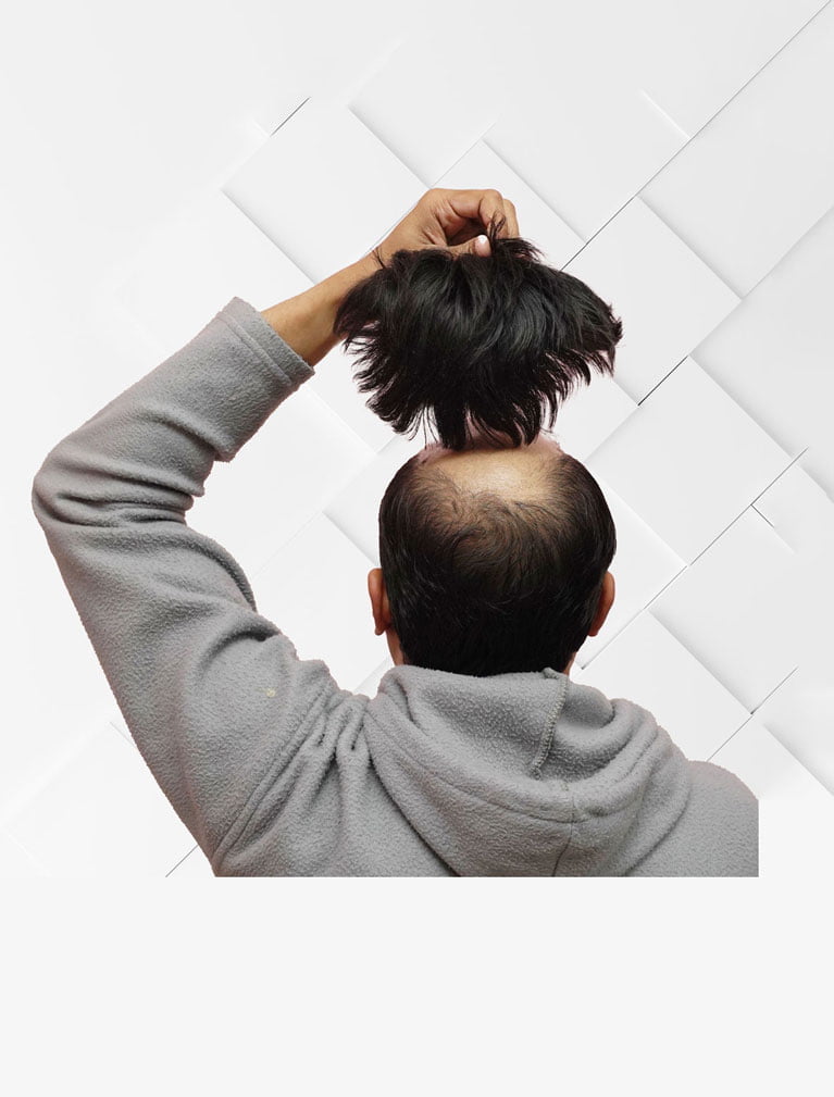neharkar-studio-home-non-surgical-mobile-slide